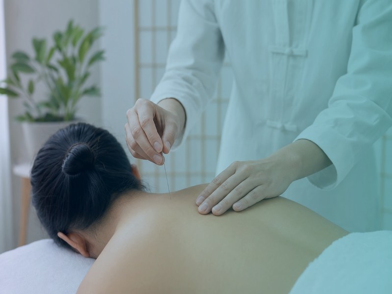 Acupuncture at Taradale Physiotherapy Massage and Wellness Centre Calgary